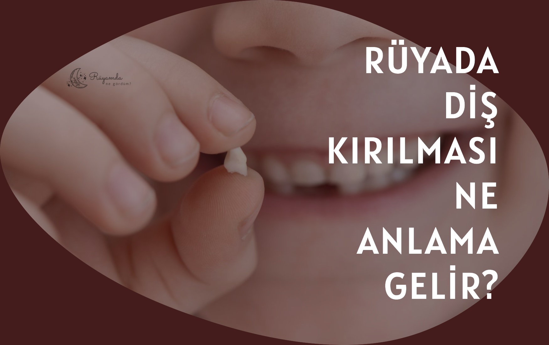 Rüyada Diş Kırılması Ne Anlama Gelir?